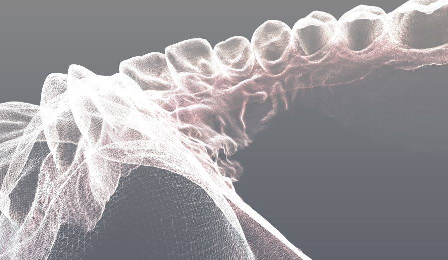 Digital image of teeth and gums from inside the mouth