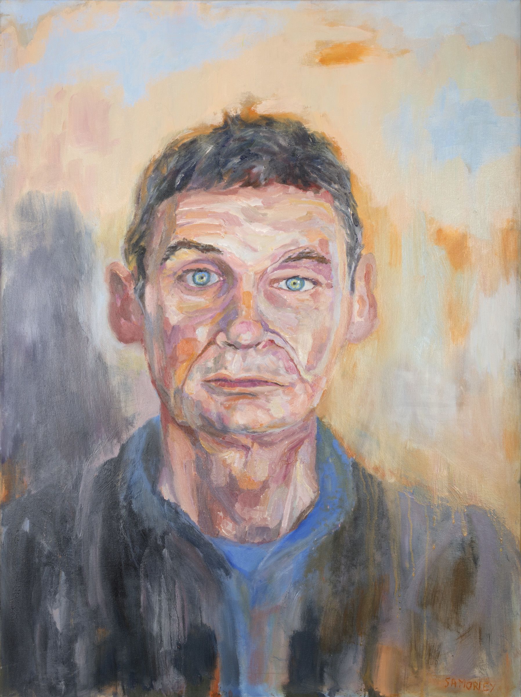 Portrait of Chris, face on, wearing his prosthetic.
