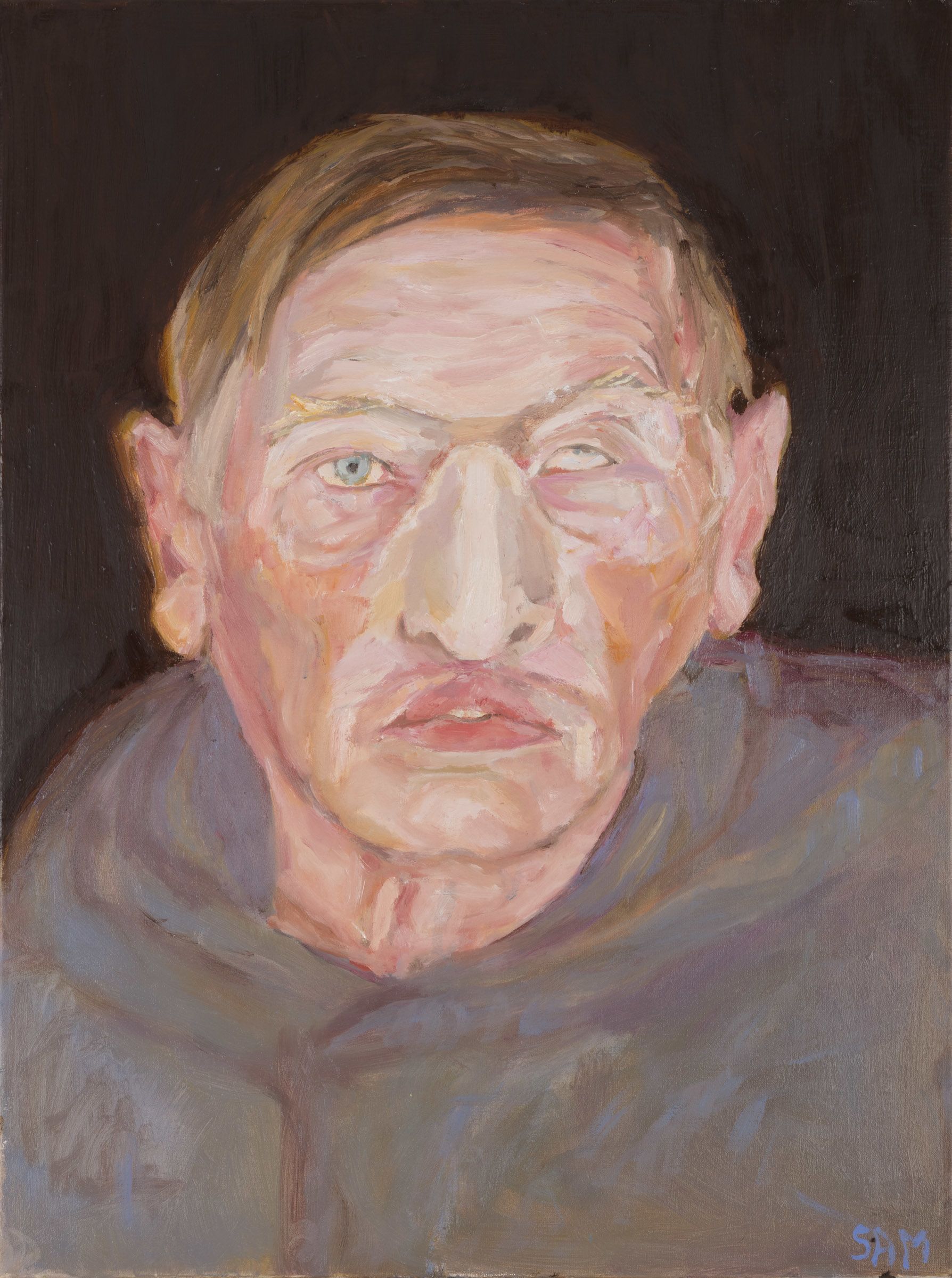 Painting of David wearing a conventionally manufactured prosthesis.