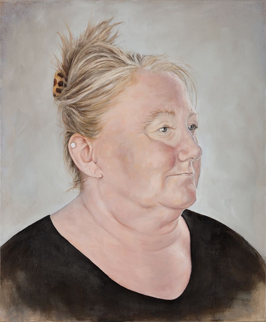 Painting of Suzie wearing her eye prosthesis from one side